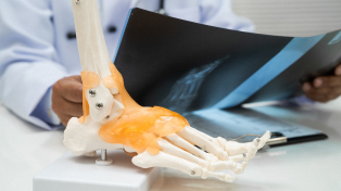 Understanding minimally invasive foot and ankle surgery