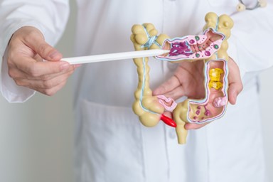 Colorectal Surgery_384x256px