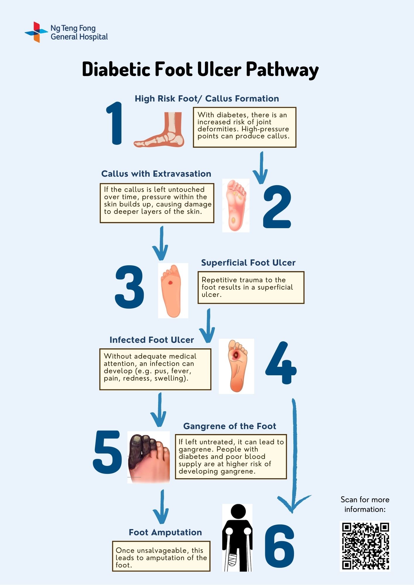 Diabetic Foot Ulcer Pathway