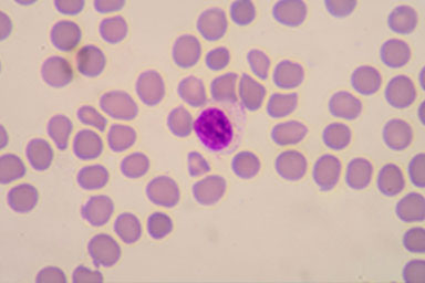 Haematology