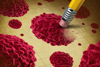 Oncology - Medical & Radiation