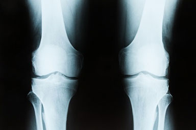 Orthopaedic Surgery