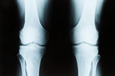 Orthopaedic Surgery