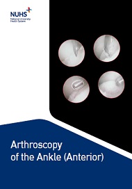 Arthroscopy of the Ankle (anterior)