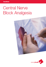 Central Nerve Block Analgesia