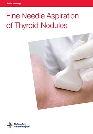 Fine Needle Aspiration of Thyroid Nodules