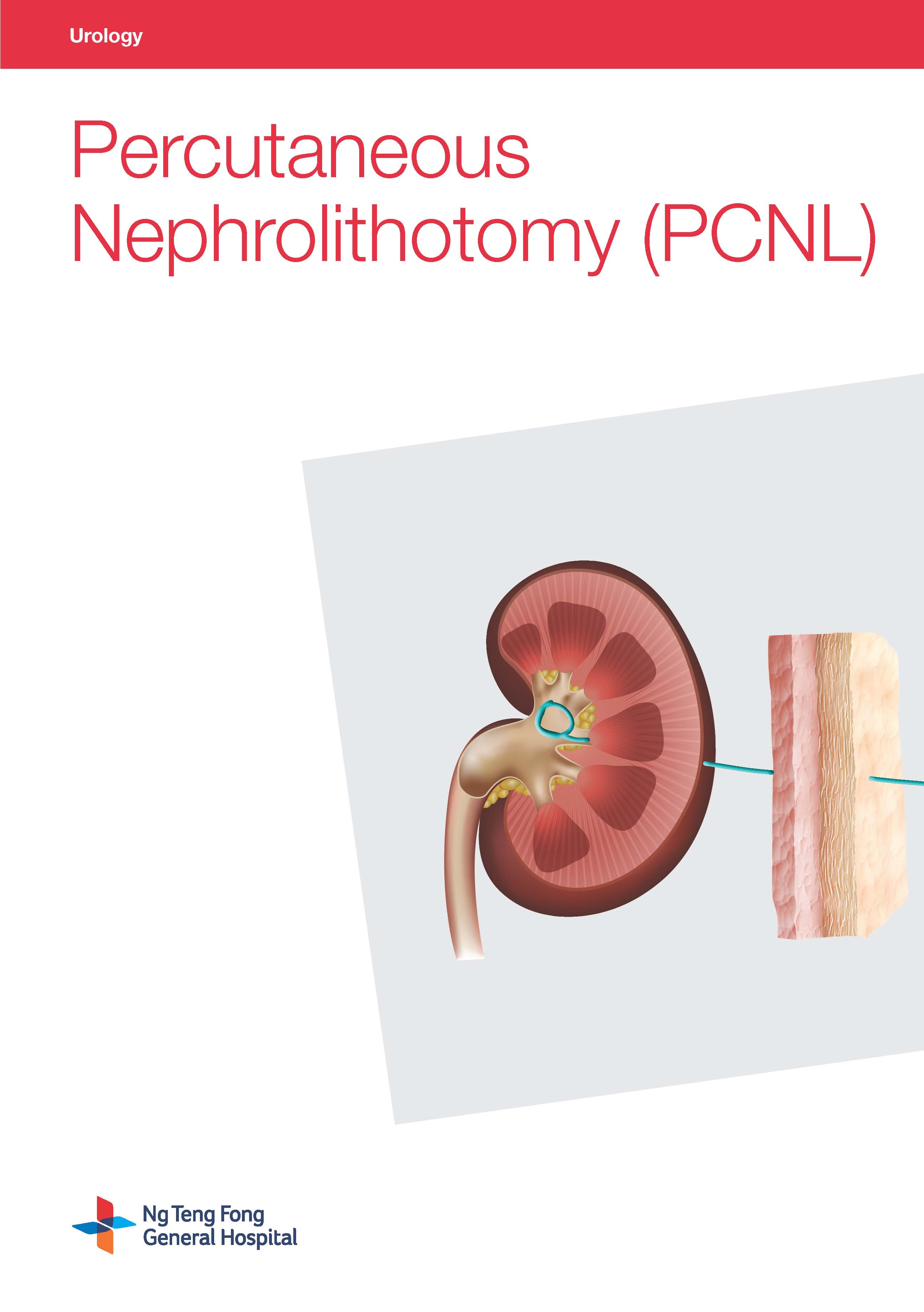 Percutaneous Nephrolithotomy (PCNL)