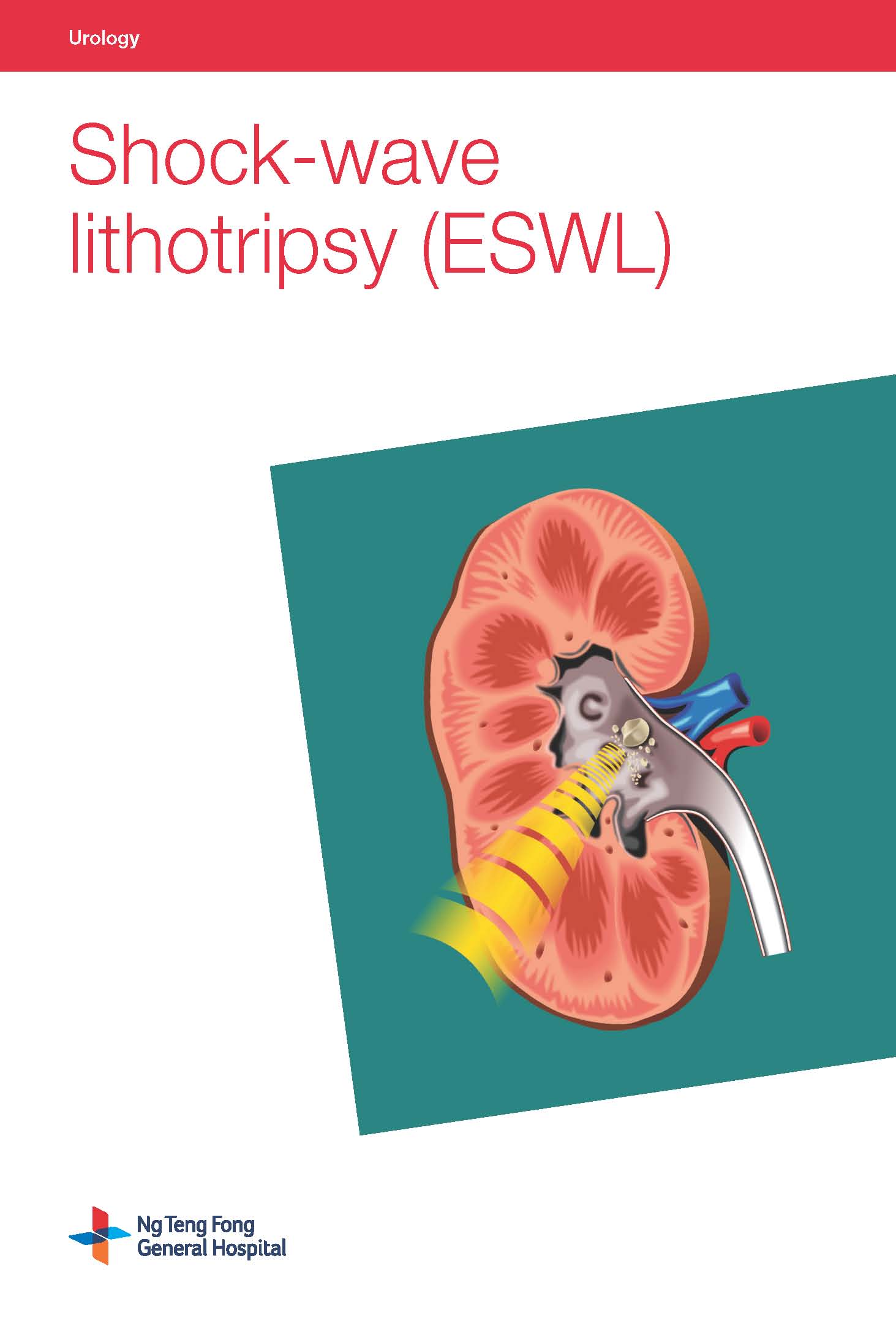 Shock-wave lithotripsy (ESWL)