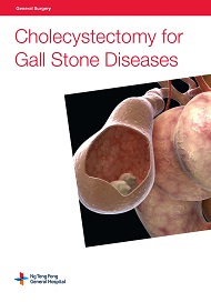 Cholecystectomy for Gall Stone Diseases