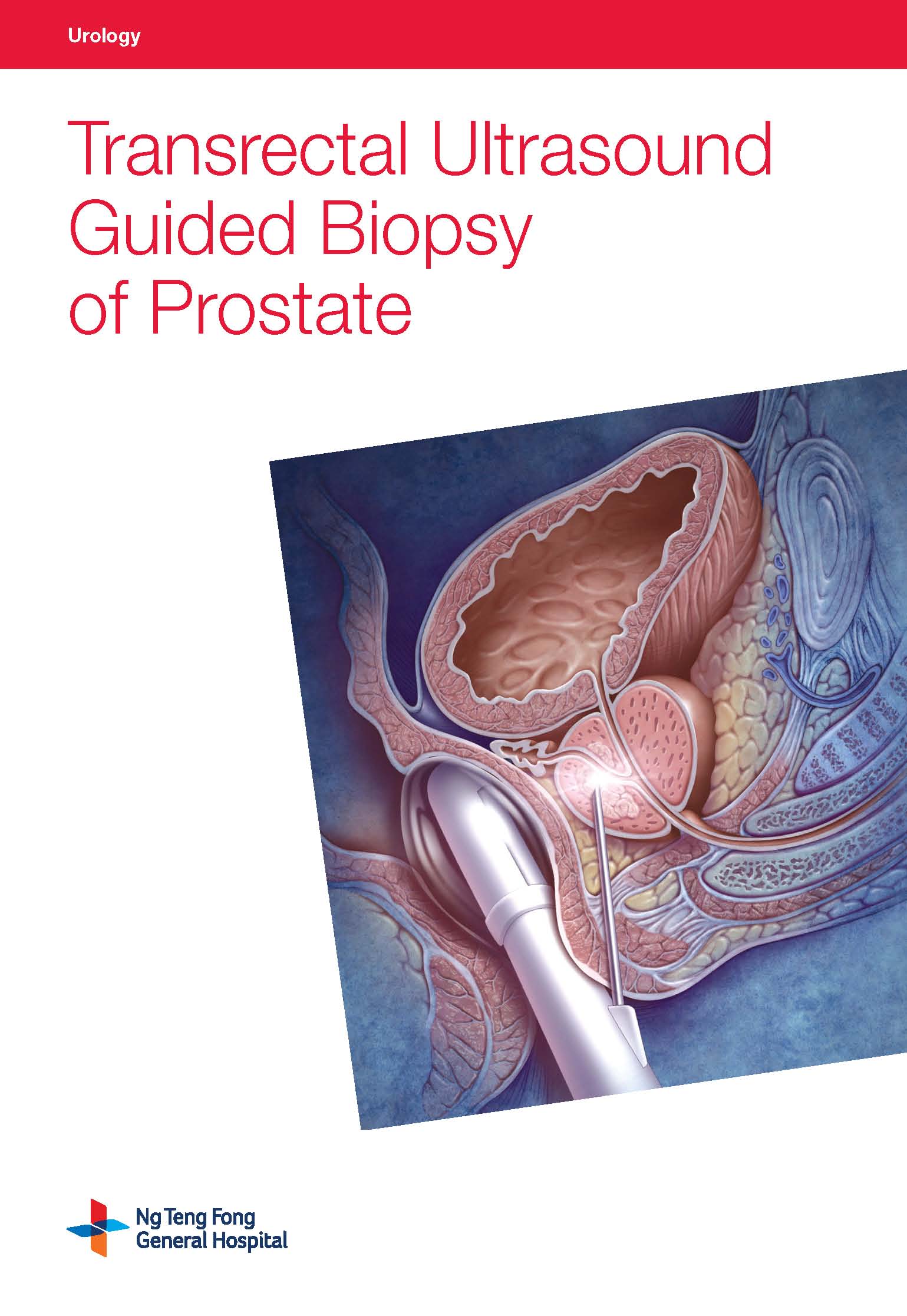 Transrectal Ultrasound Guided Biopsy of Prostate