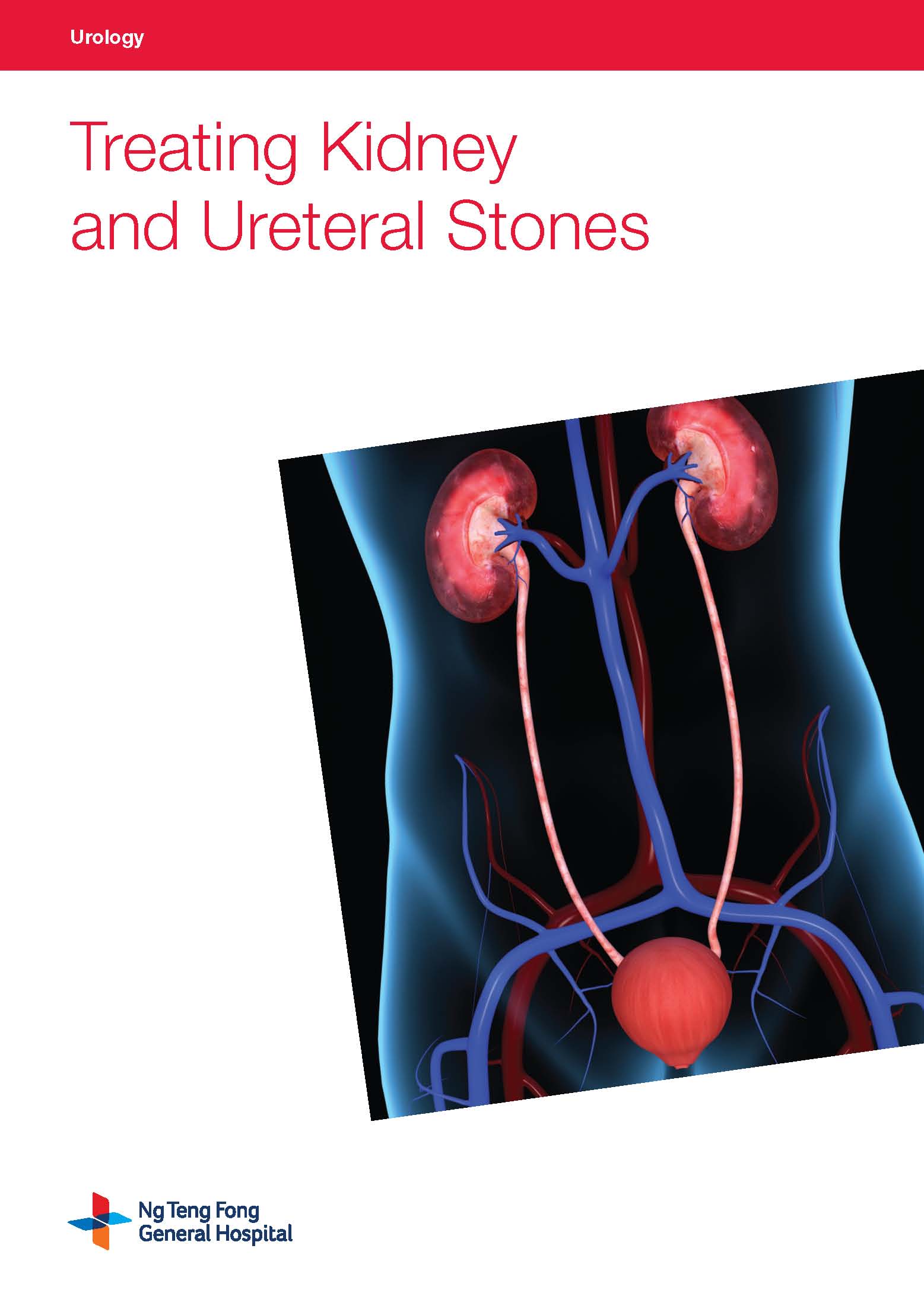 Treating Kidney and Ureteral Stones
