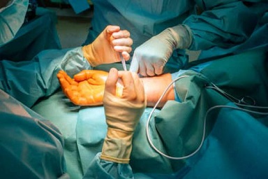 Hand & Reconstructive Microsurgery